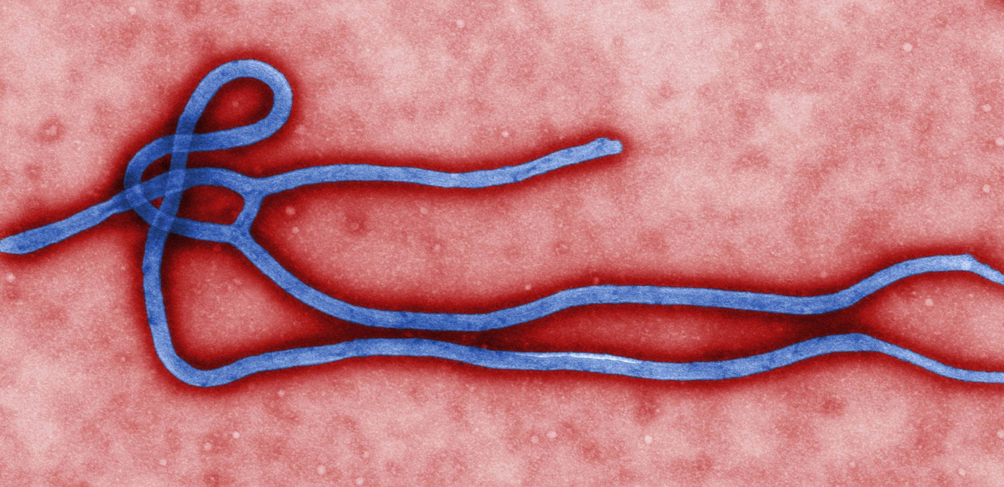 Alla caccia di Ebola